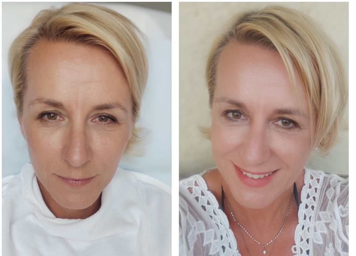 Megint fiatalodtam, köszi Nucleofill!